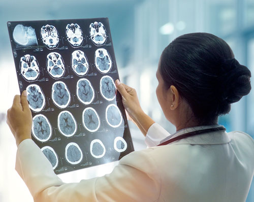 Female doctor looking at images of the the brain for Alzheimer's research.